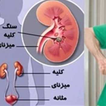دستگاه دفع ادرار یا تصفیه خون